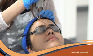 Mengenal Pico Laser dan Erbium Laser untuk Perawatan Kulit