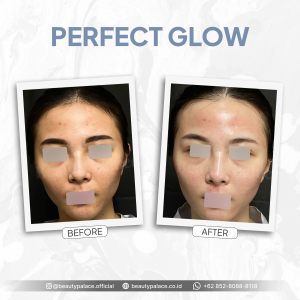 Perfect Glow 2