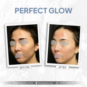 Perfect Glow 3