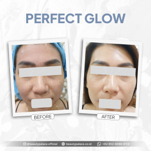Perfect Glow 4