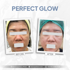 Perfect Glow 5