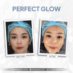 Perfect Glow 7