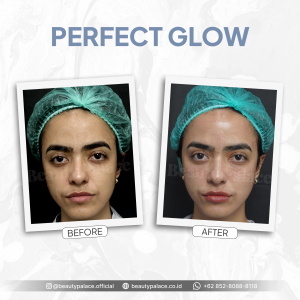 Perfect Glow 8