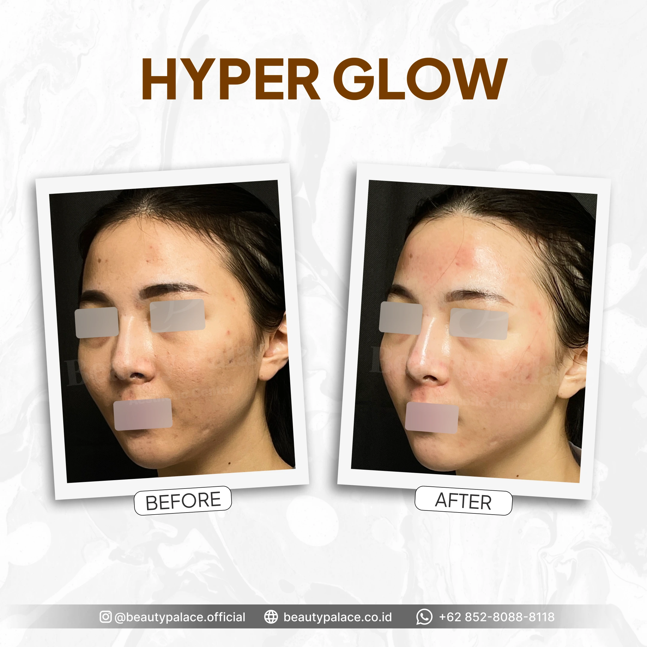 HyperGlow 3