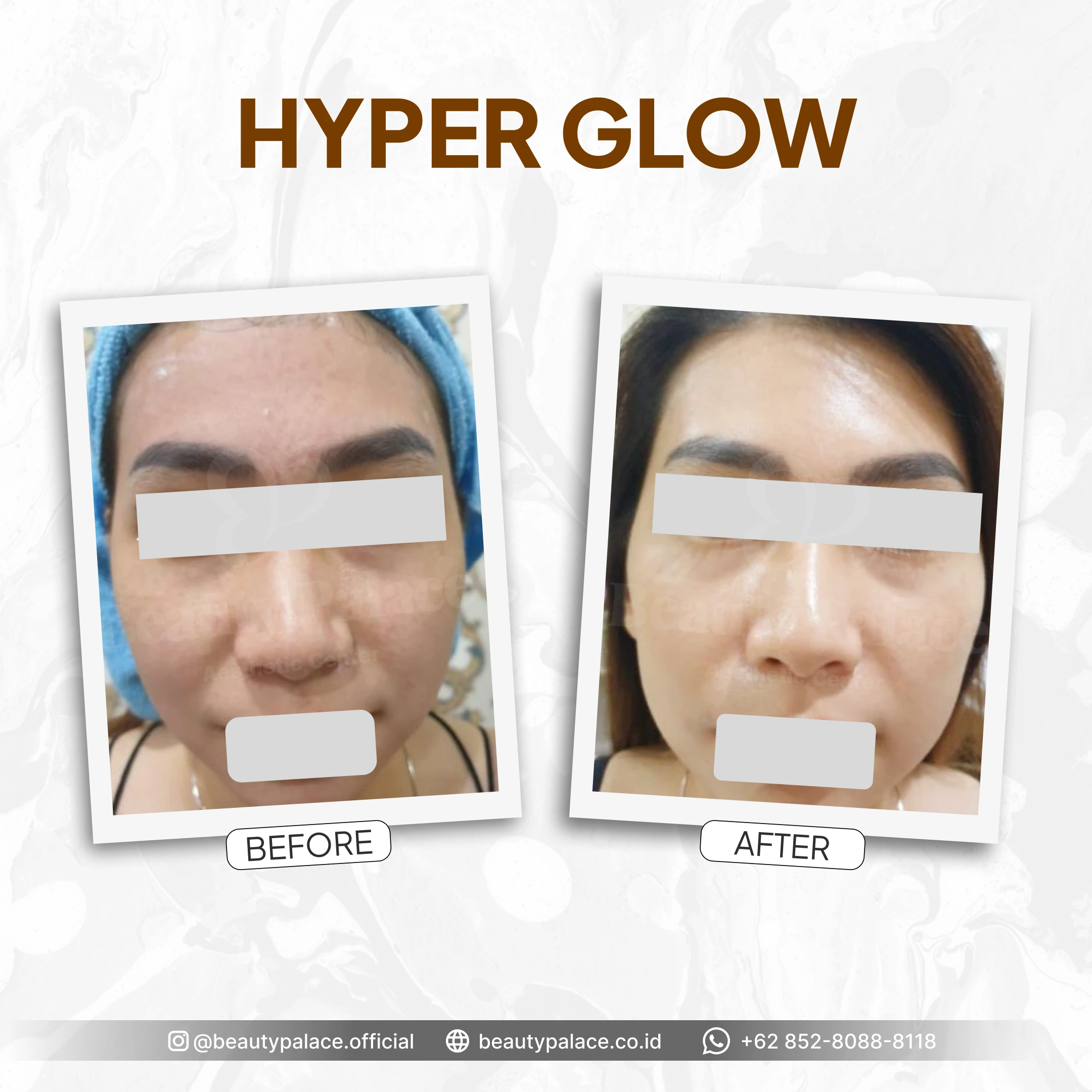 HyperGlow 4
